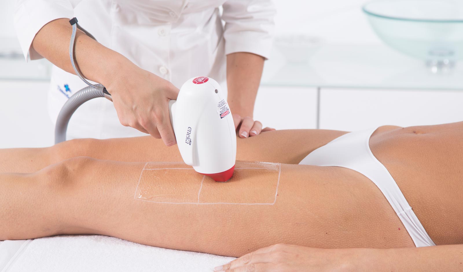 eneka-laser-treatment